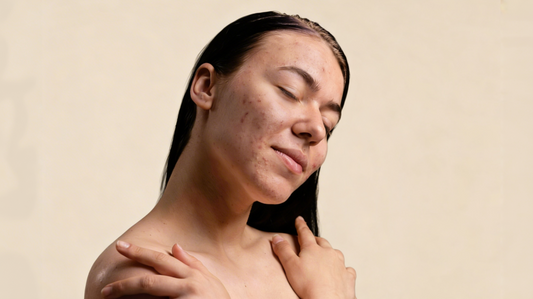 The Gut-Skin Connection: Why Your Skin Reflects Internal Health